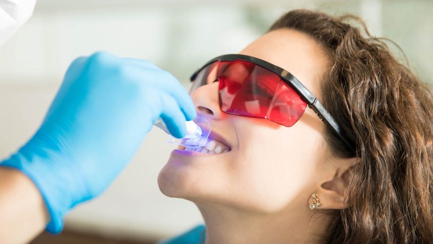 Blanqueamiento dental