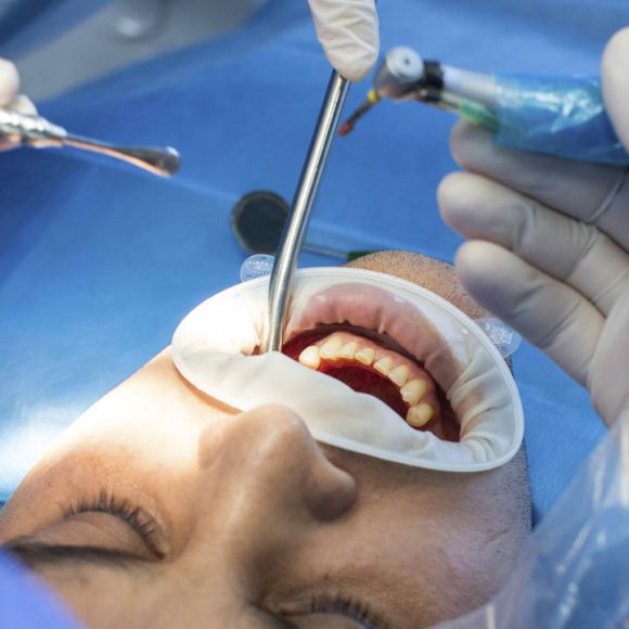 Cirugía oral y maxilofacial Cirugía oral y maxilofacial