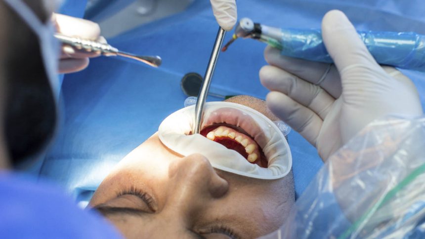 Cirugía oral y maxilofacial Cirugía oral y maxilofacial