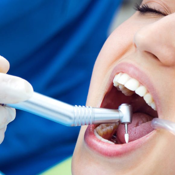 Restauraciones Restauraciones