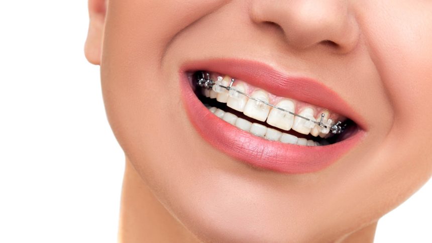 Ortodoncia Ortodoncia